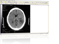 Viewing Documents