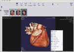 DICOM Viewer Options Menu